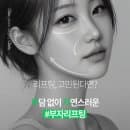 강남성형외과 치유성형외과의원 요금·예약·주차 한번에 정리